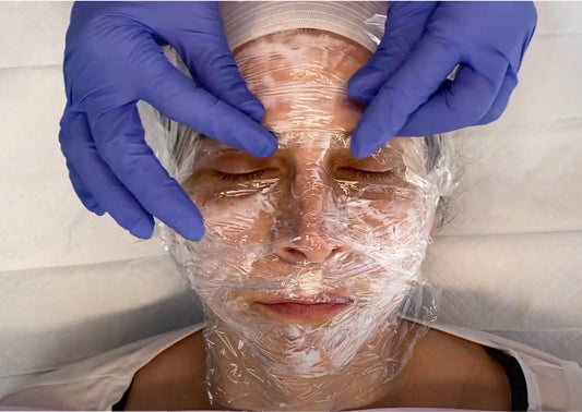 Numbing Application for Aurorae Plasma Treatment