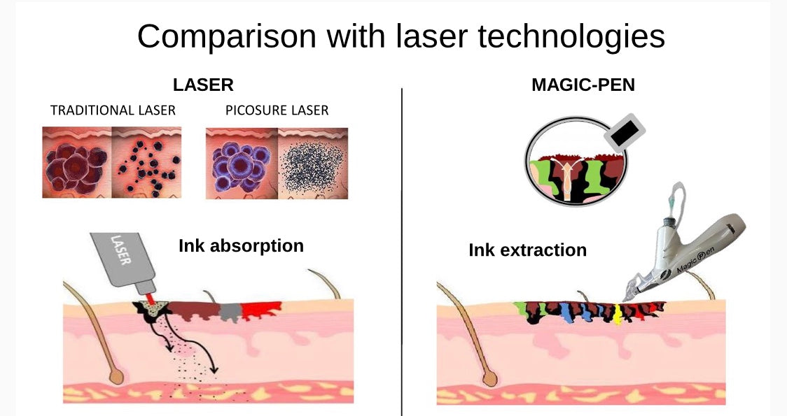 Magic Pen Tattoo Ink Extractor